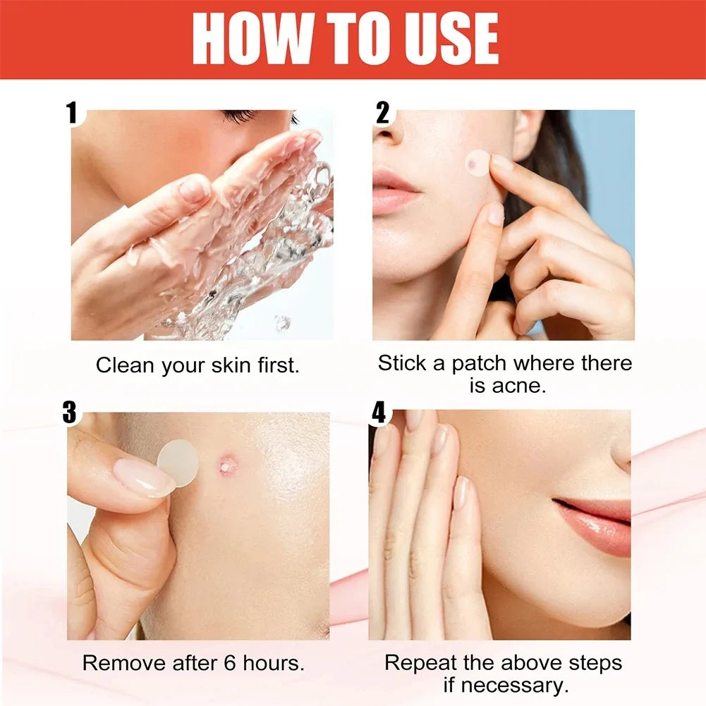 144Pcs/Set Face High-End Skin Care Pimple Acne Patches Professional Healing Absorbing Spot Sticker Covering for Covering Acne