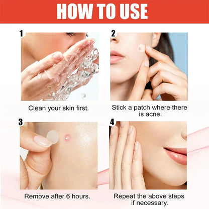 144Pcs/Set Face High-End Skin Care Pimple Acne Patches Professional Healing Absorbing Spot Sticker Covering for Covering Acne