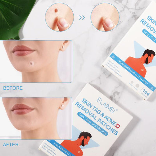 Mighty Pimple Buster