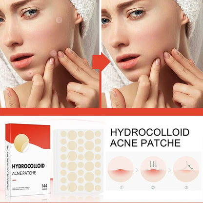 144Pcs/Set Face High-End Skin Care Pimple Acne Patches Professional Healing Absorbing Spot Sticker Covering for Covering Acne